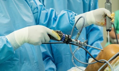 Understanding Shoulder Arthroscopy: A Minimally Invasive Solution in Slovakia